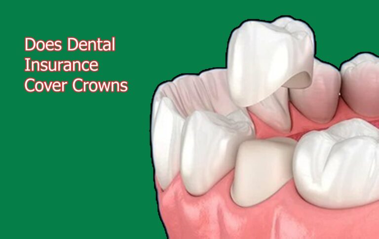 Does Dental Insurance Cover Crowns